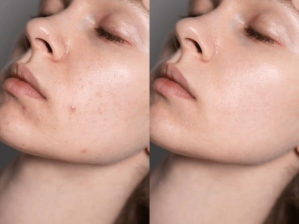 Zafrani Beauty Cream For Whitening & Glow