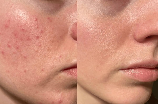 Zafrani Beauty Cream For Whitening & Glow